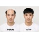 Men's Short Hairpiece for Thinning & Balding | Mediterranean Scalp Solution Covers Gray Hairs | Invisible Topper Prevents Loss and Adds Volume