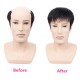 Men's Short Lace Frontal System for Hair Loss, Hairline Reconstruction, Grey Coverage, and Bald Spot Fix with Real Human Hair