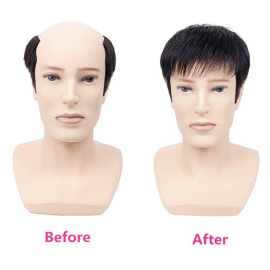 Men's Short Lace Frontal System for Hair Loss, Hairline Reconstruction, Grey Coverage, and Bald Spot Fix with Real Human Hair