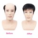 Men's Short Lace Frontal System for Hair Loss, Hairline Reconstruction, Grey Coverage, and Bald Spot Fix with Real Human Hair