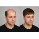Men's Invisible Hair System - Short Straight Synthetic Fiber for Baldness Correction and Top Coverage